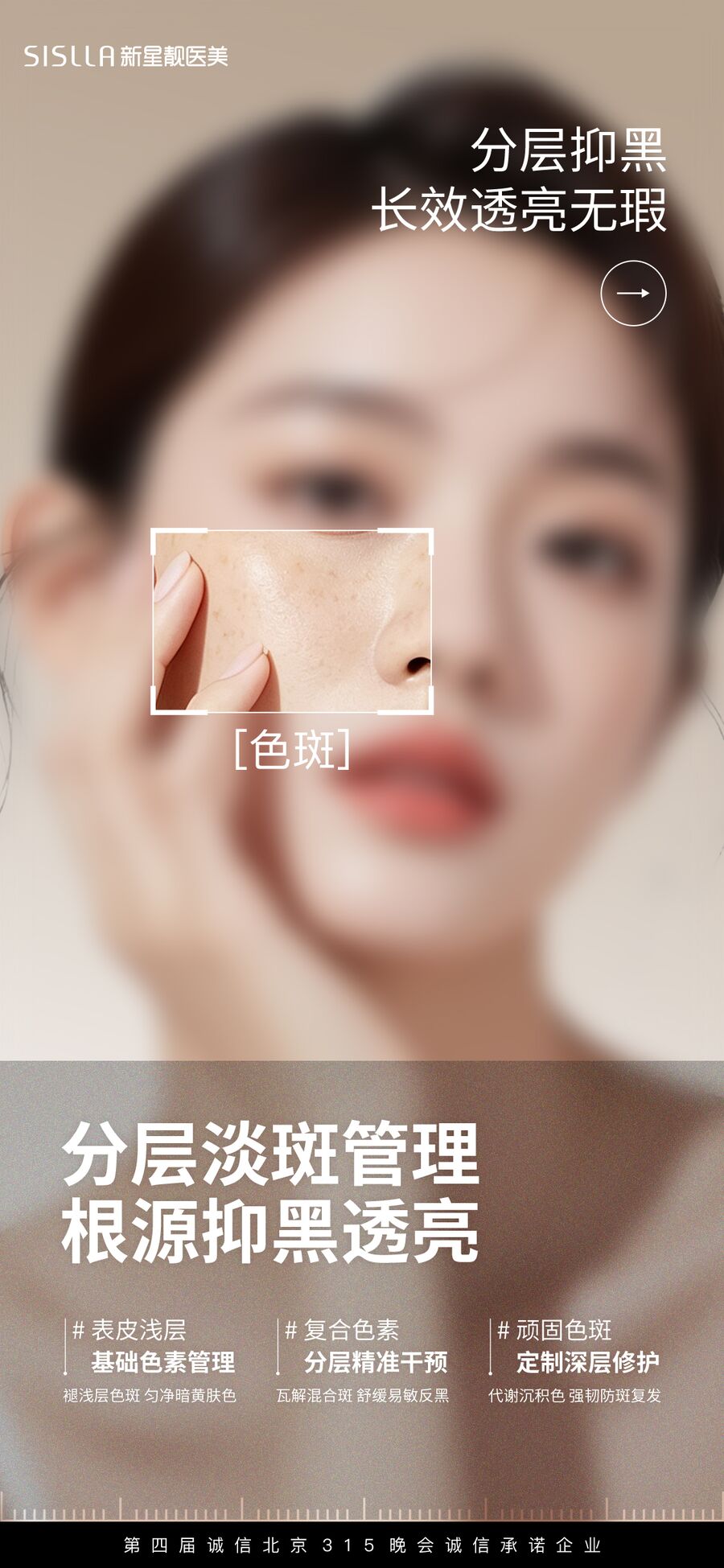 分层淡斑管理