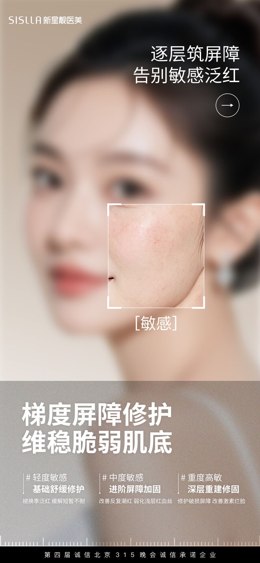梯度屏障修护